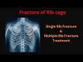 Ribs Fracture | Rib fracture Treatment at home | Single &  Multiple Rib Fracture Treatment |