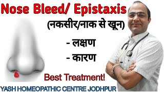 Nose bleed in child | epistaxis | नकसीर । नाक से खून । Best homeopathic treatment