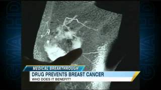 Aromasin: New Drug May Help Prevent Breast Cancer