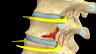 Back and Spinal cord - Digital Anatomy Atlas