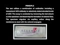 Pregnancy Test - miscarriage symptoms Pregnancy Test - miscarriage symptoms