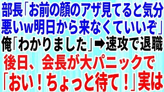 【スカッとする話】部長「顔のアザ見てると気分が悪いw明日から来なくていいぞw」俺「わかりました」速攻で退職すると→後日、会長「ちょっと待て！」結果w【感動する話】