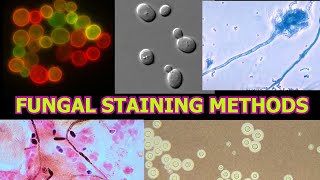 FUNGAL STAINING METHODS