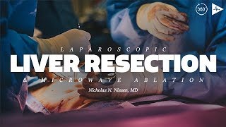 Laparoscopic Liver Resection and Microwave Ablation by Dr. Nicholas N. Nissen | Case Trailer