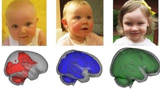 தாய்ப்பால் மூளை வளர்ச்சிக்கு உதவுமா? Does Breastfeeding help Brain Growth?