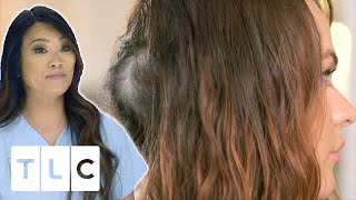 Dr Lee Removes Pear Shaped Bump On Woman’s Head | Dr Pimple Popper