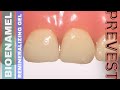 Bioenamel || Remineralizing & Desensitizing Gel || Prevest Denpro