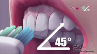 روش صحیح مسواک زدن | دندانستان