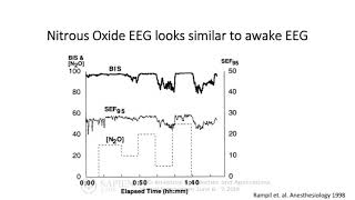 Quantifying Depth of Anesthesia with EEG | Dr  Sarah Eagleman