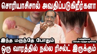 நீங்க நார்மல் ஆயிடுவீங்க | Psoriasis symptoms , causes and treatment | S.Karthikeyan | Mr ladies