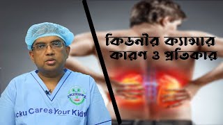 কিডনি ক্যান্সার ও তার চিকিৎসা।Kidney Cancer-causes, symptoms, diagnosis \u0026treatment। হাসপাতাল