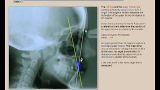 orthodontic cephalometric points and angles.mp4