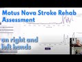 A Motus Nova Hand Assessment on Both Right and Left sides | Stroke Rehab