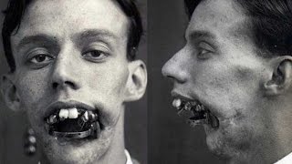 15 Creepy Vintage Medical Photos