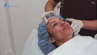 Sculptra by Eterna MD Medical Rejuvenation Center | Orlando, FL