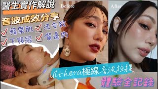 Ulthera 極線音波拉提效果全記錄/醫生實作解說/改善法令紋/蘋果肌/嘴邊肉/下顎線條/讓人變年輕的秘密