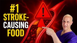 This Food Is a Stroke Ready to Happen — Stop Eating It Now! Dr. Mandell