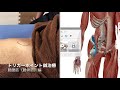 腸腰筋（腸骨筋）のトリガーポイント鍼治療！ぎっくり腰、ヘルニア編