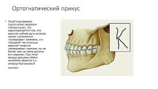 Прикус и разновидности  прикуса