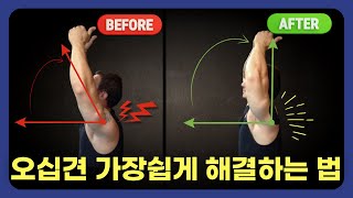 지긋지긋한 어깨통증 없애는 5가지 운동 (Frozen Shoulder Exercises)