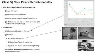 Neck Pain with Cervical Radiculopathy | Presentation + Treatment