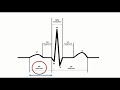 corrected qt interval qtc calculation with bazett s formula