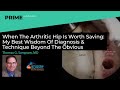 When The Arthritic Hip Is Worth Saving: My Wisdom Of Diagnosis & Technique - Thomas G. Sampson, MD