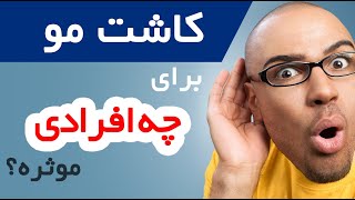 کاشت مو برای چه افرادی مناسبه؟ و برای چه کسانی بی فایده هستش؟؟؟