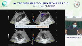 Tiếp cận chẩn đoán hình ảnh đau bụng cấp 1/4 trên phải - BS Nguyễn Quang Trọng
