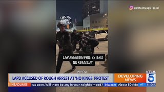 Activists say teenager’s shin was broken during arrest at L.A. ‘No Kings’ protest 