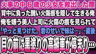 【感動する話】火事の中6歳の少女を救出した際背中に負った醜い火傷痕を隠して生きる俺。俺を嫌う美人上司に火傷の痕を見られて「やっと見つけた。君のせいで妹は」→目の前に黒塗りの高級車が停まり…【泣