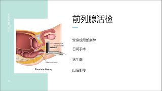 KiSS Episode 10: 前列腺特异性抗和前列腺活检与您