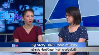 มีผื่น ปวดขา ถ่ายเหลวเฝ้าระวัง “โรคฮีน็อค” พบบ่อยในเด็ก : พบหมอรามา ช่วง Big Story 26 ก.พ.61(2/5)