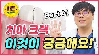 치아 크랙 이것이 궁금해요! Best 4! - 바른치과생활