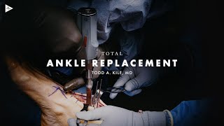 Ankle Reconstruction by Todd A. Kile, MD | Preview