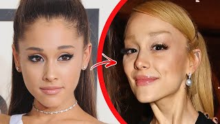 Top 10 Hollywood Actors Who Destroyed Their Face With Fillers