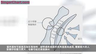 90%的跑友在跑步中受過傷，教你如何遠離它們！ 一、脛前痛 二、跟腱炎 三、應力性骨折 四、足底筋膜炎 五、跑步膝