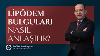 Lipödem Bulguları Nasıl Anlaşılır?