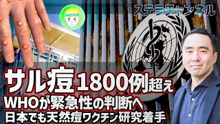 【サル痘】ニュース、ヨーロッパやアメリカなどの確定例が1800例超え【米国CDC、ウイルス、NEWS、天然痘、歴史、健康、猿とうウイルス】