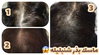 رويش مجدد مو با ماسك بذر شنبليله!Hair regrowth with mask fenugreek seeds!