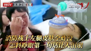 消防战士救火发生爆炸，全身炸伤左腿皮肤几乎全没，睁眼第一句“战友找到了吗”让人忍不住泪崩……【生命缘第3季】