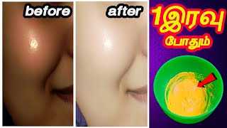 ஒரே இரவில் என் முகம் வெள்ளையானது | How to get fair skin fast | skin whitening tips in tamil