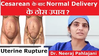 Cesarean के बाद Normal Delivery कैसे करे? Normal Delivery After C Section