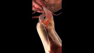 Carotid Arteries Under Attack: How Plaque Leads to Stroke #medicine #anatomy #shorts