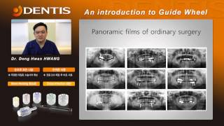 [덴티스임플란트] Guide Wheel 제품 설명