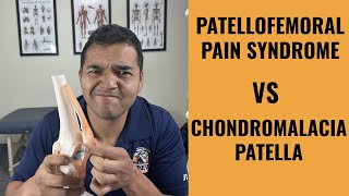 Chondromalacia Patella vs Patellofemoral Pain Syndrome