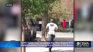 NYC Parks Employee Slashed Across Face And Chest On The Job In The Bronx