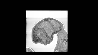 Microanatomy and Development of the Dwarf Male of Symbion pandora (Phylum Cycliophora): New...