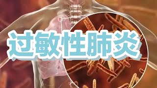 什么是过敏性肺炎？症状及治疗