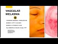 a clinical presentation on effectively treating melasma and pigment by dr. irene de la peña